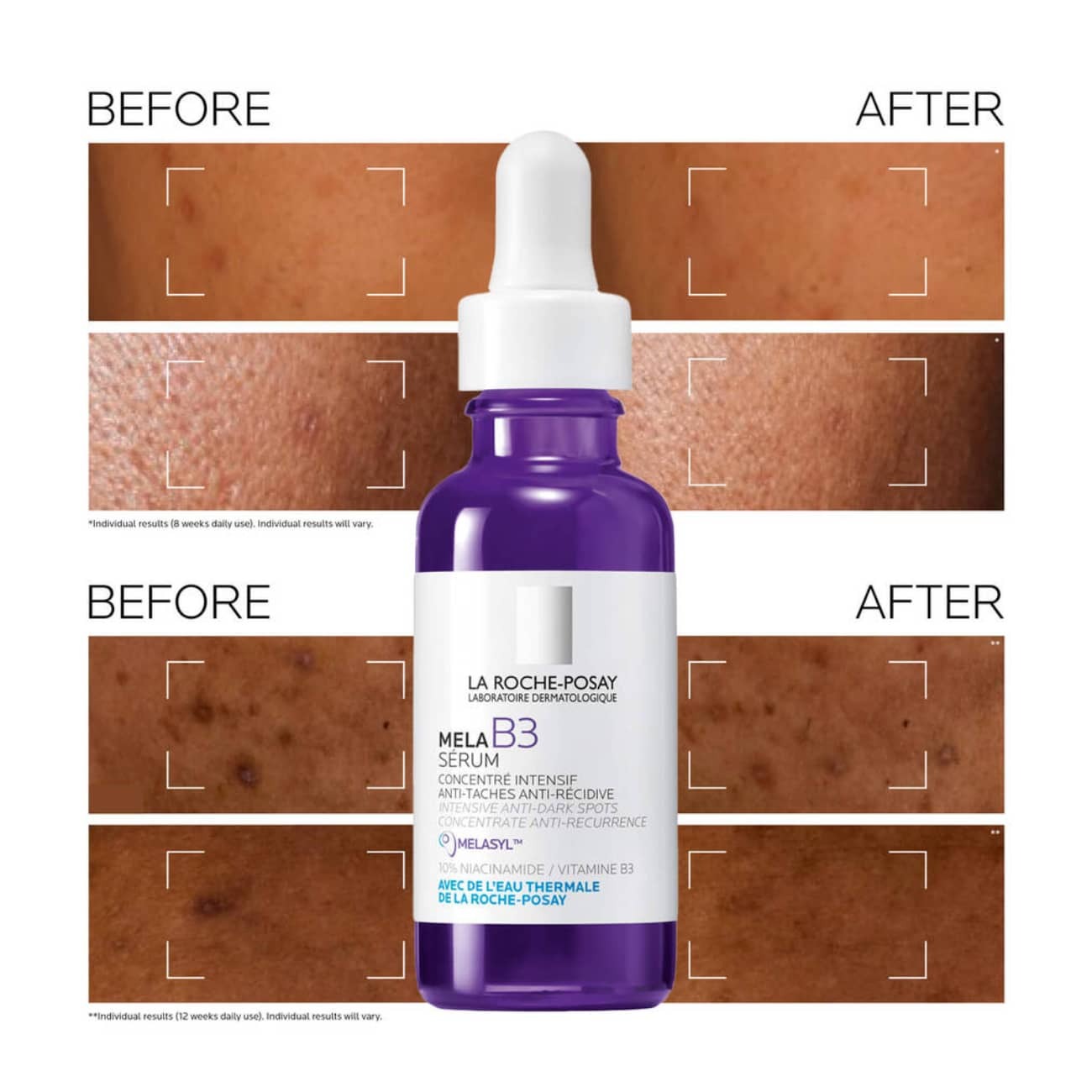 La Roche-Posay Mela B3 Sérum 30ml