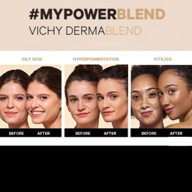 Vichy Dermablend Fond Teint Base Fluida Cor Sand 35 30ml